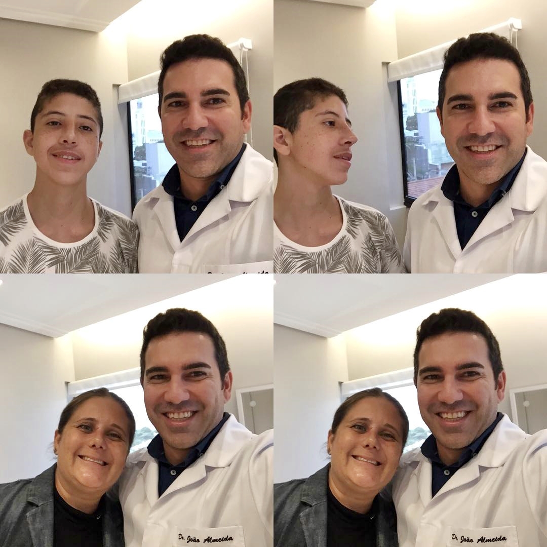 Tirar o curativo pós rinoplastia e ver a reação de satisfação dos pacientes não tem preço