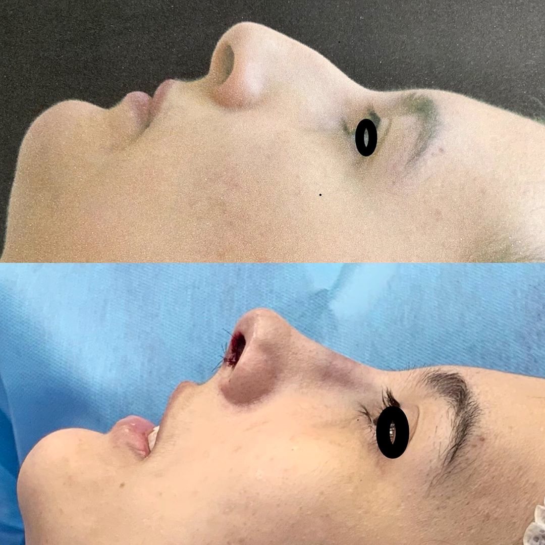 Estudo da perfilometria facial