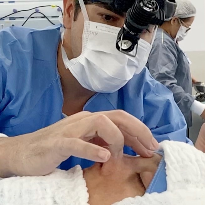 Toque final após rinoplastia com esse perfil dos sonhos!