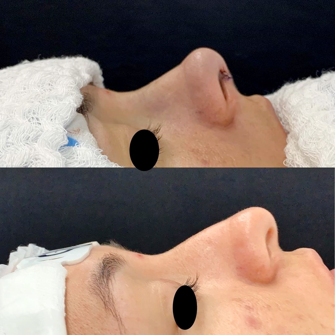 Mais uma transformação essa semana!