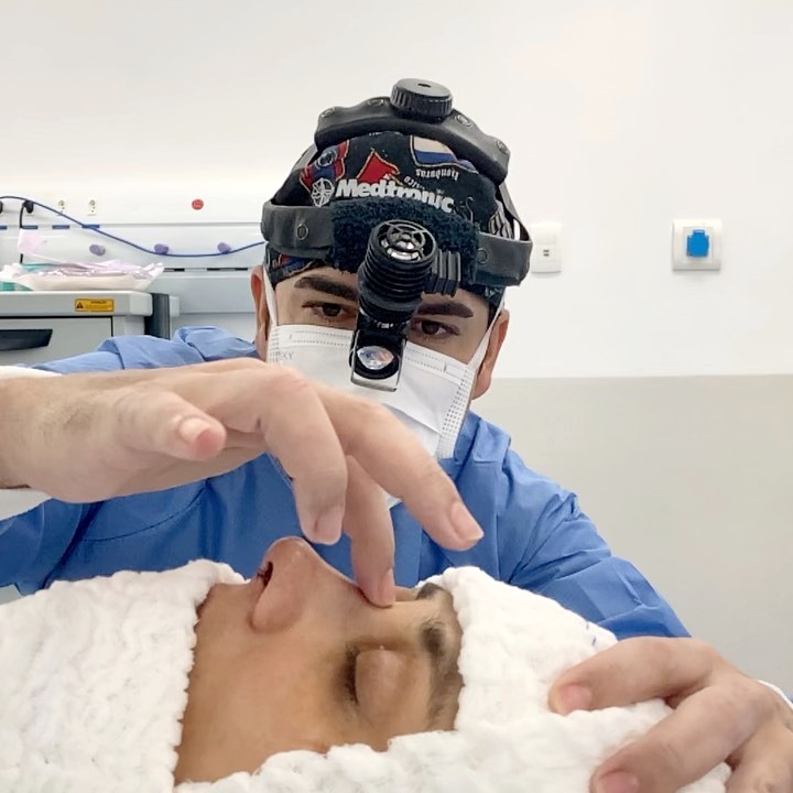 Hoje a rinoplastia serviu para tratar uma laterorrinia