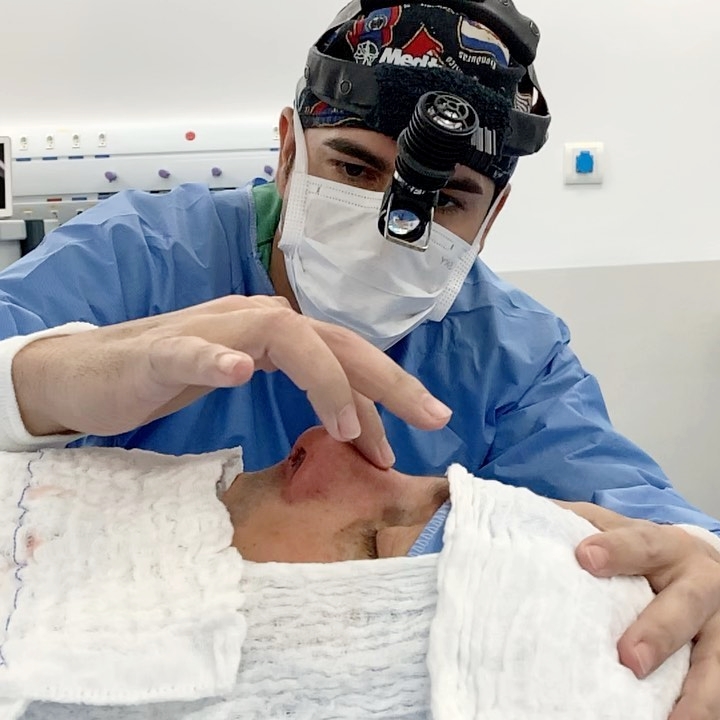 Feriado também é dia de rinoplastia