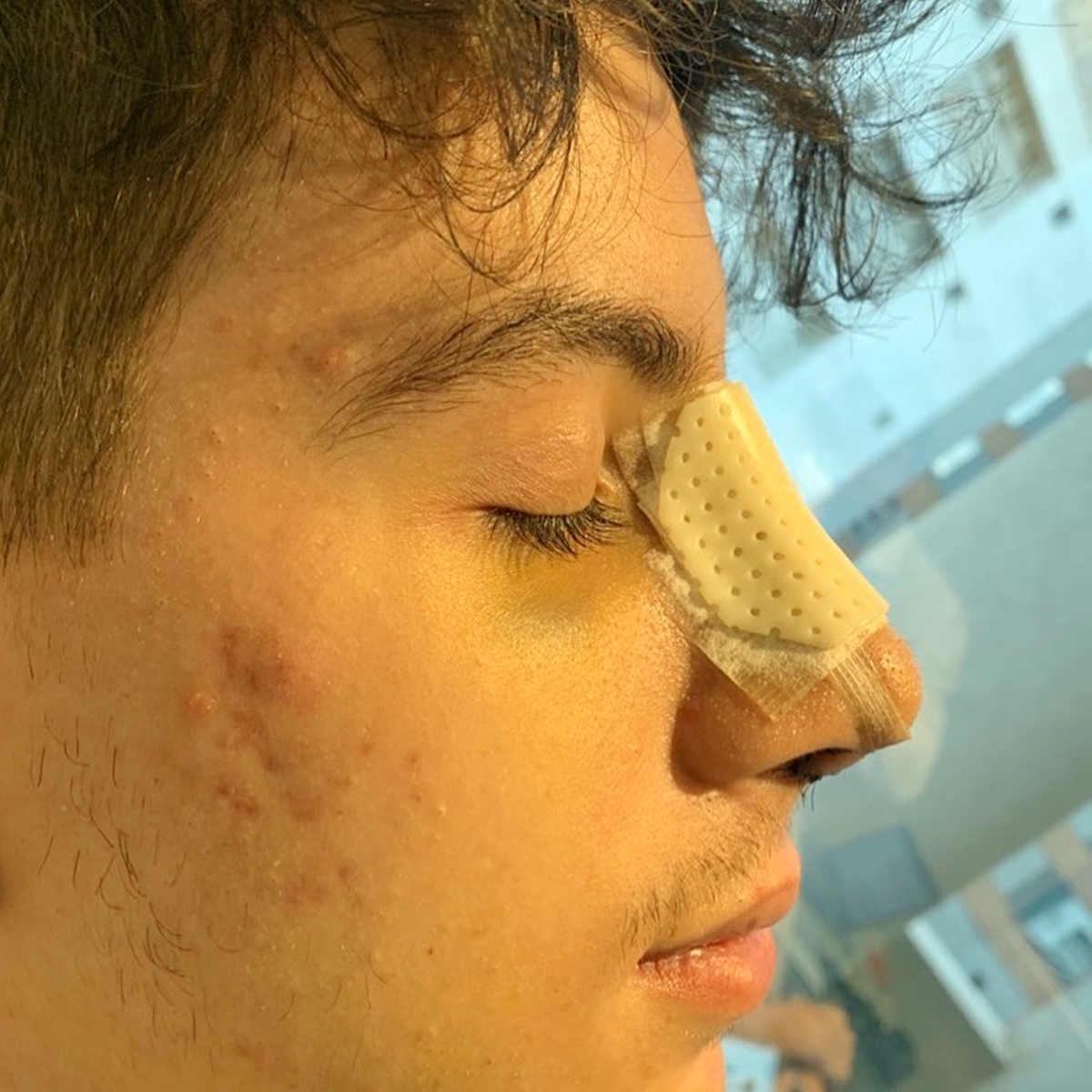 Dia de descobrir o novo nariz