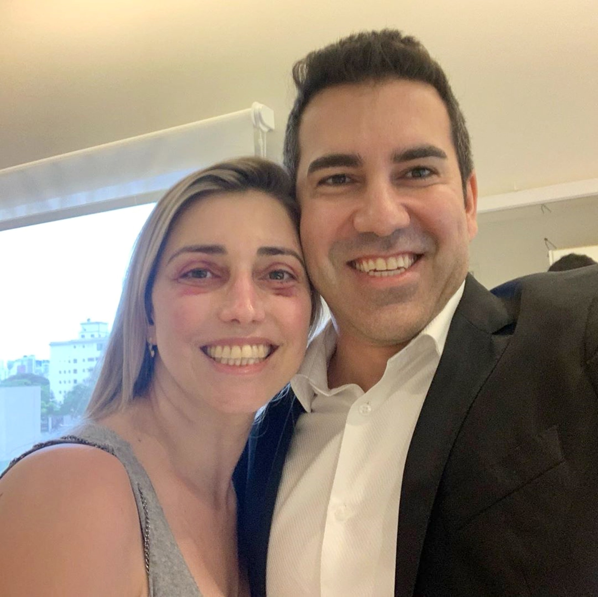 Apenas 4 dias de cirurgia de pálpebras blefaroplastia